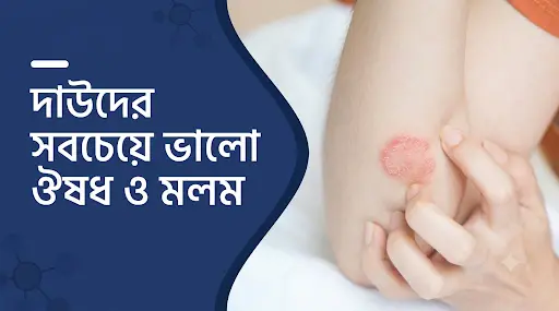 দাউদের ভালো ওষুধের নাম, দাউদের মলম, দাউদের চিকিৎসার ঔষধ, দাউদ দূর করার উপায়, দাউদের ক্রিম, দাউদ কেন হয়, ফাঙ্গাল ইনফেকশনের ওষুধ, দাউদের অ্যান্টিফাঙ্গাল ক্রিম, দাউদ চুলকানির ওষুধ, রিংওয়ার্ম ট্রিটমেন্ট